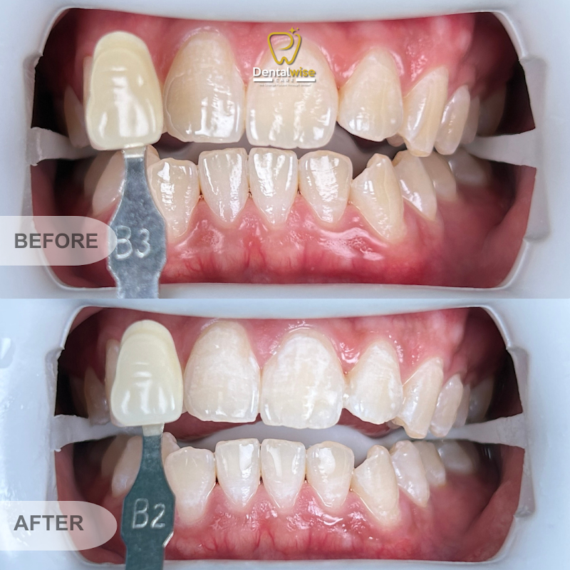 Klinik Pergigian DentalWise Care Perling